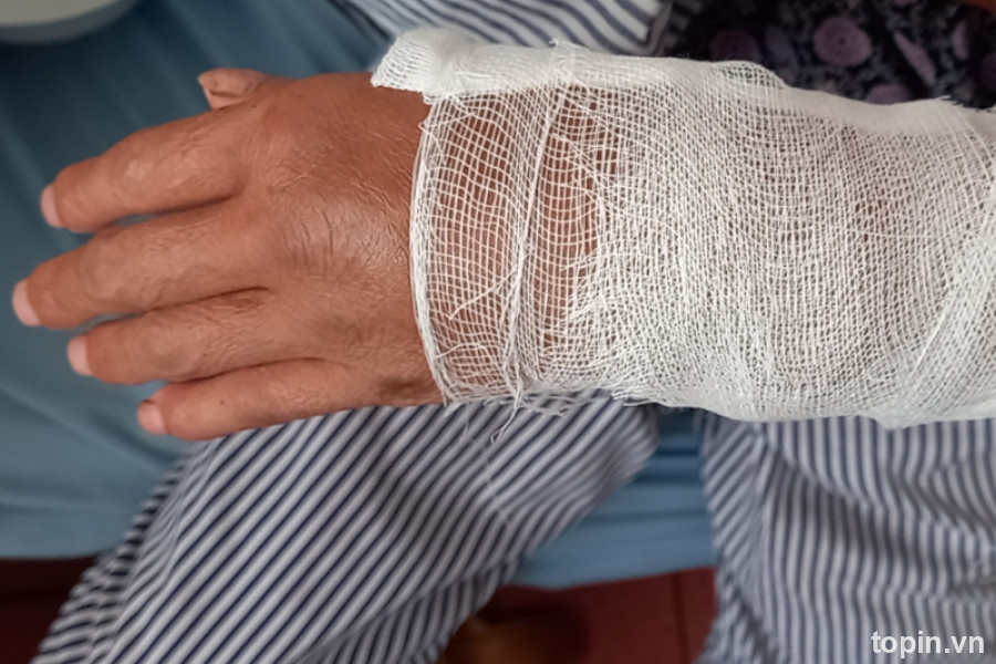 Thầy Lang Bó Thuốc Huy Gù